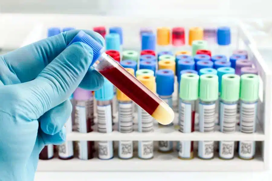 Ebbecke Verfahrenstechnik Suspension Beispiel Blut